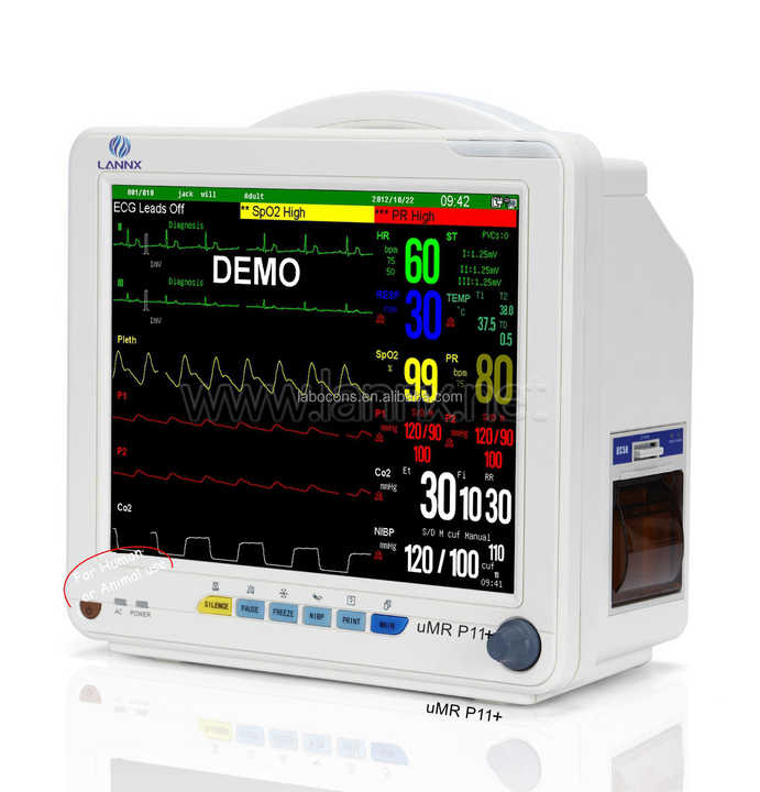 LANNX UMR P11+ High Quality Hospital Clinics Apparatuses Bedside Monitor ECG Machine Medical Portabl