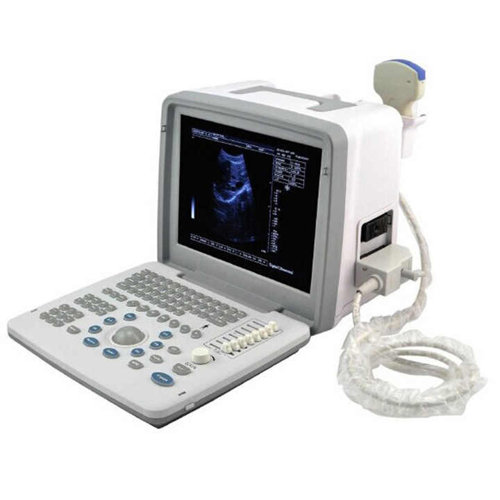 Portable B/W Ultrasound Low Price Full Digital Diagnostic Ultrasound Scanner Handheld Sonoscape S50