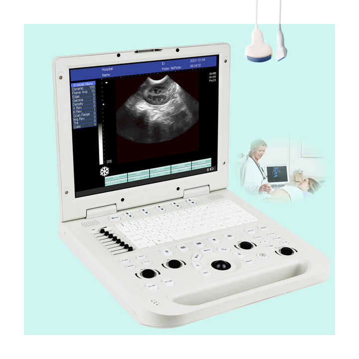 N20 Portable Ultrasound Scanner for Humans Pets Color Ecocardiografo Ultrasonic Diagnostic Apparatus