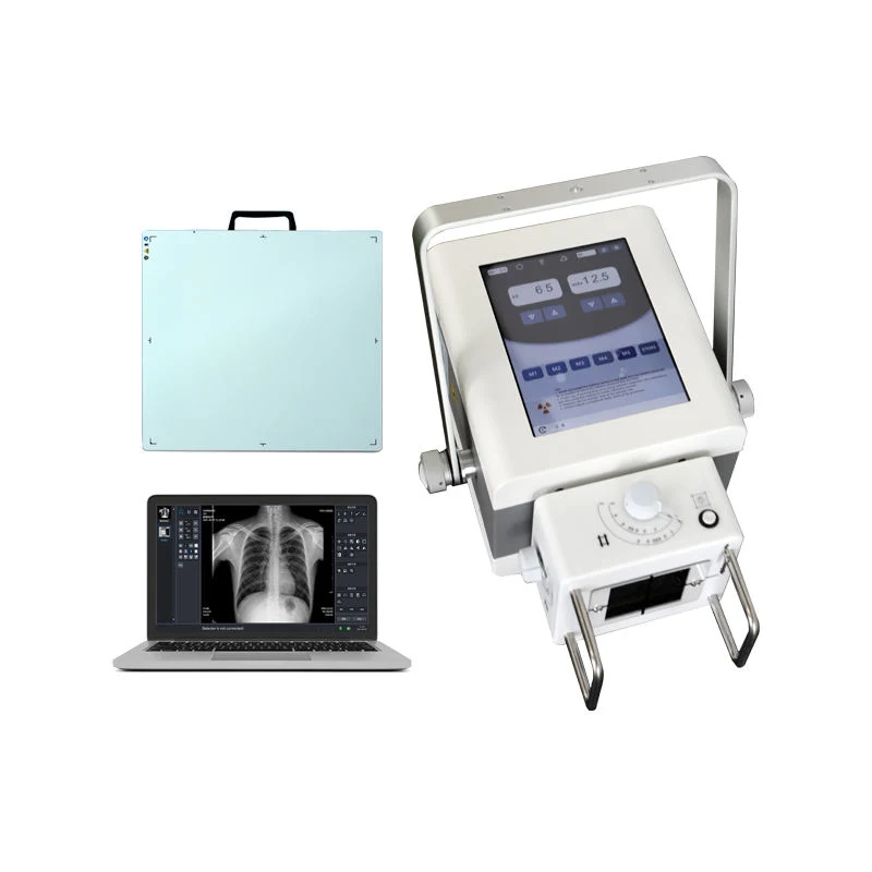 Portable X Ray Machine Medical 5.3kW Mobile Price List of Digital High Frequency Portable DR X-ray Machine for Human