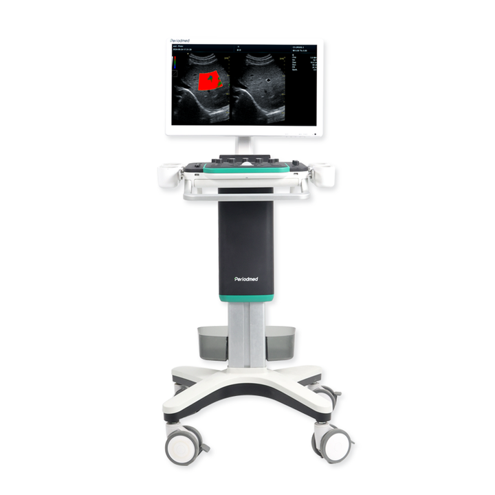 Yonker Support ODM/OEM Trolley Color Doppler Ultrasound Machine Ultrasound Machine Medical Trolley H